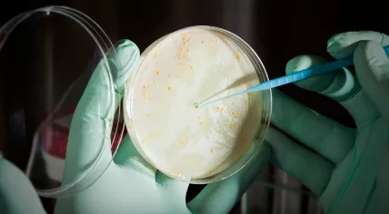 Petri Dish