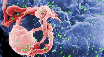 HIV-1