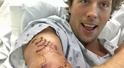 Freek Vonk in hospital after being bitten by a reef shark