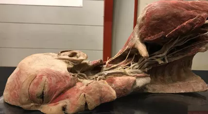 Real Human Bodies exhibition