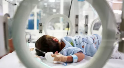 Baby in an incubator