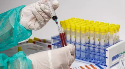 Blood test