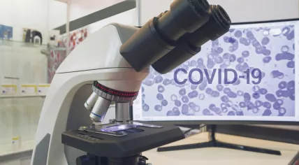 Stock image of a Covid-19 coronavirus microscope analysis 