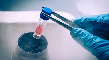 Stem cell storage