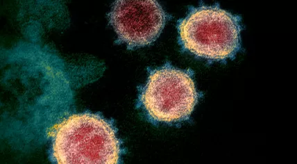 Electron microscope image of SARS-CoV-2, also known as the 2019-nCoV or novel coronavirus