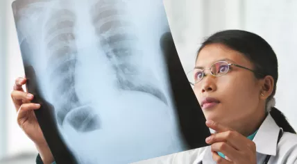 Doctor looking at an X-ray