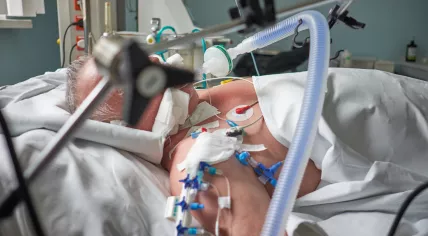 Patient on a ventilator