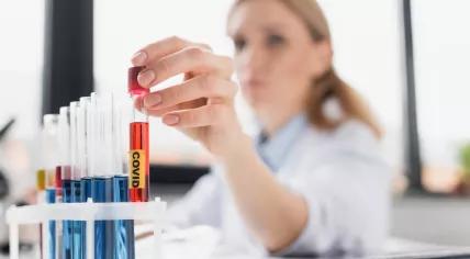 Test tube with sample and covid