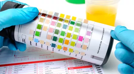 Urine drug test strips