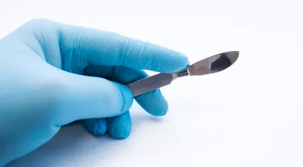 Hand holding scalpel.