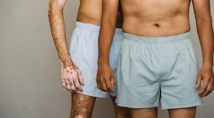 Men wearing boxer shorts