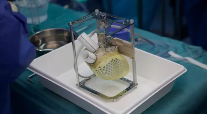 First artificial heart implanted in the Netherlands at UMC Utrecht in early November 2021