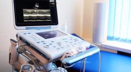 Ultrasound machine