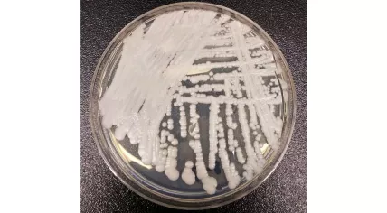 Candida auris growing on a Petri dish culture plate. 2016