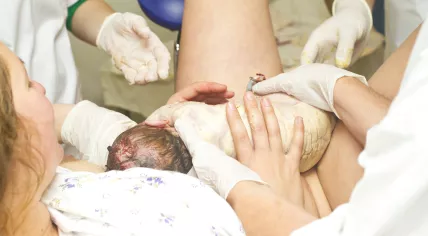 Childbirth