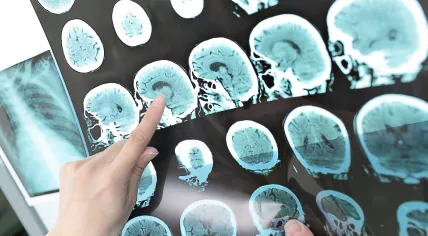 Doctor viewing a CT scan