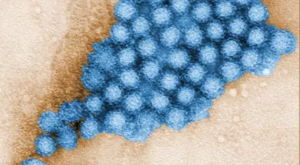 Norovirus