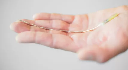 An innovative head implant designed to address chronic migraine.