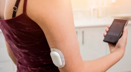 A continuous glucose monitoring pod, used in combination with an insulin pump to help people manage type 1 diabetes