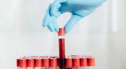 Cropped view of doctor in latex glove holding test tube with a blood sample