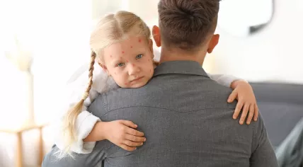  Father holds his daughter, who is ill with chickenpox
