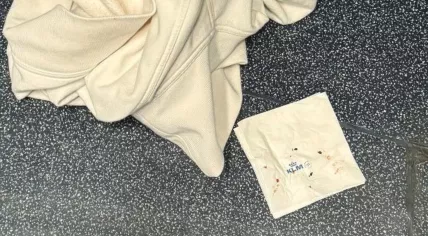 An American family alleged a bed bug infestation of their business class seats on a KLM flight from Atlanta to Amsterdam caused serious discomfort and skin complaints. This photo claiming to show bed bugs crushed on a KLM cocktail napkin was submitted as part of a lawsuit. Mar. 21, 2025