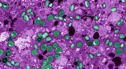 Colorized transmission electron micrograph of mpox virus particles (green) found within infected VERO E6 cells (magenta). The virus particles are in various stages of maturity, which accounts for differences in shape.