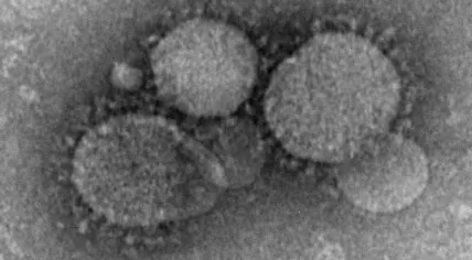 MERS-CoV_electron_micrograph1