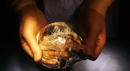 Breast implant