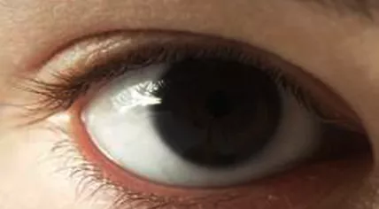 Dark_eyes