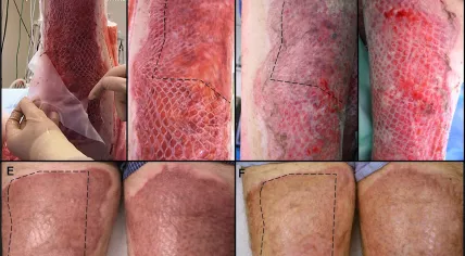 Figure3_CT131380_dpi600_Gardien