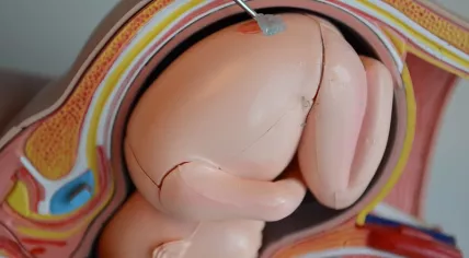 3d-print in baarmoeder