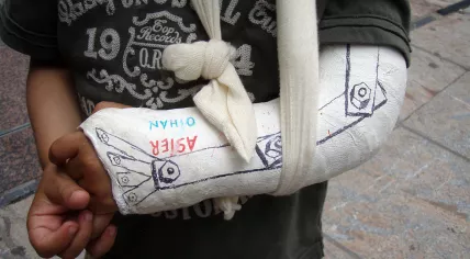 Brazo_mecánico