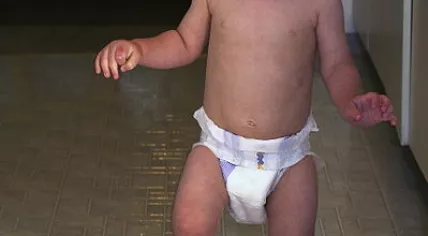 399px-Baby_diaper