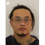 Douglas C. W., one of several people arrested in the Dacia gold artifacts robbery from the Drents Museum in Assen in January 2025