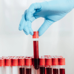 Cropped view of doctor in latex glove holding test tube with a blood sample